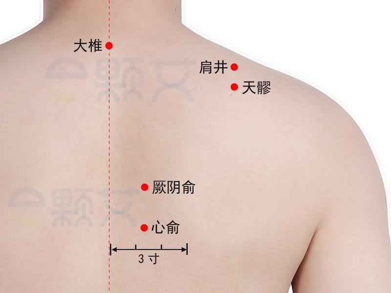厥阴俞穴位图 艾灸取穴方法 主治病症 应用经验