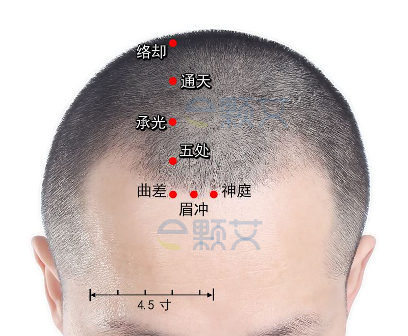 通天穴位图 艾灸取穴方法 主治病症 应用经验