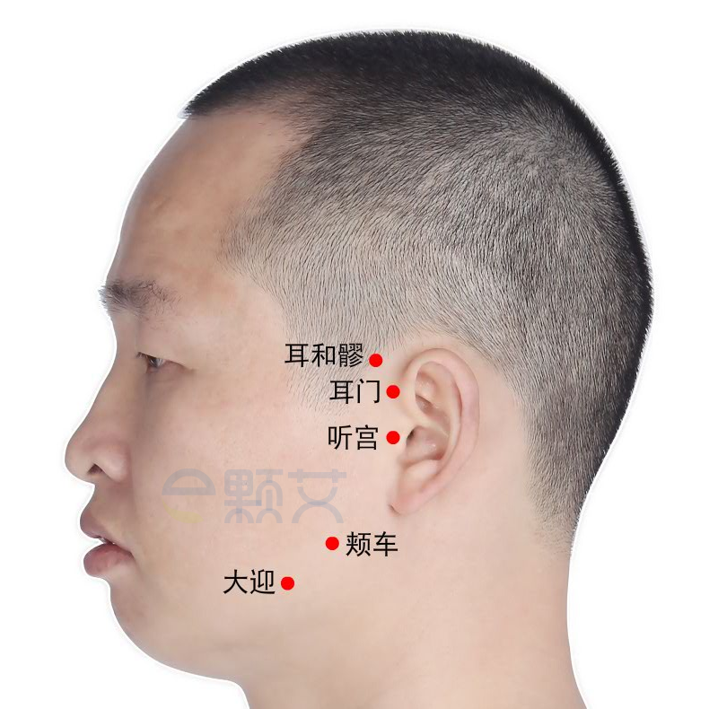 耳和髎穴位图 艾灸取穴方法 主治病症 应用经验
