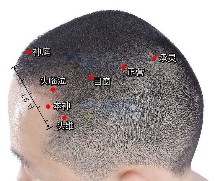 头临泣穴位图 艾灸取穴方法 主治病症 应用经验
