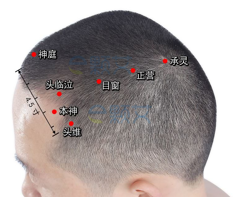 本神穴位图 艾灸取穴方法 主治病症 应用经验