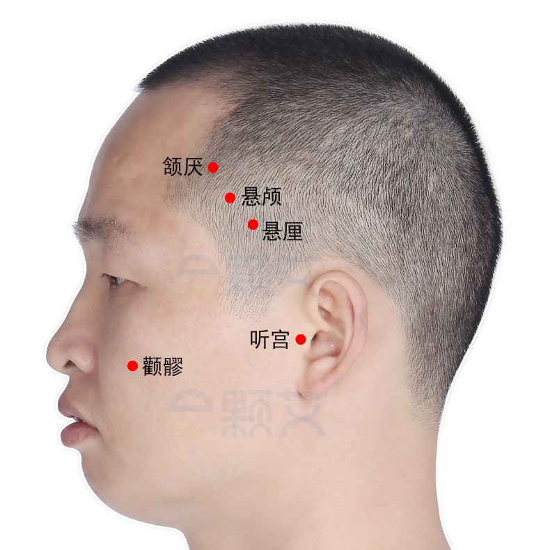 悬厘穴位图 艾灸取穴方法 主治病症 应用经验