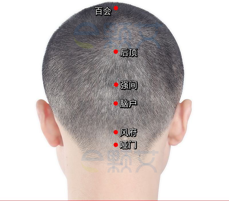 哑门穴位图 艾灸取穴方法 主治病症 应用经验