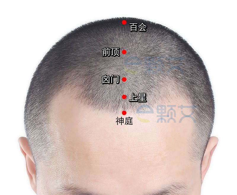 上星穴位图 艾灸取穴方法 主治病症 应用经验