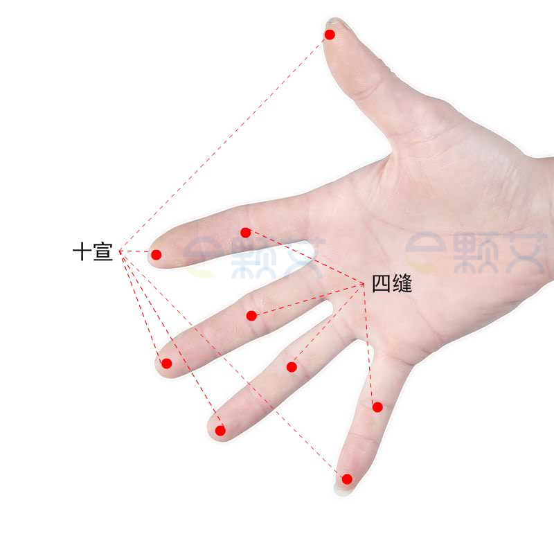 四缝穴位图 艾灸取穴方法 主治病症 应用经验